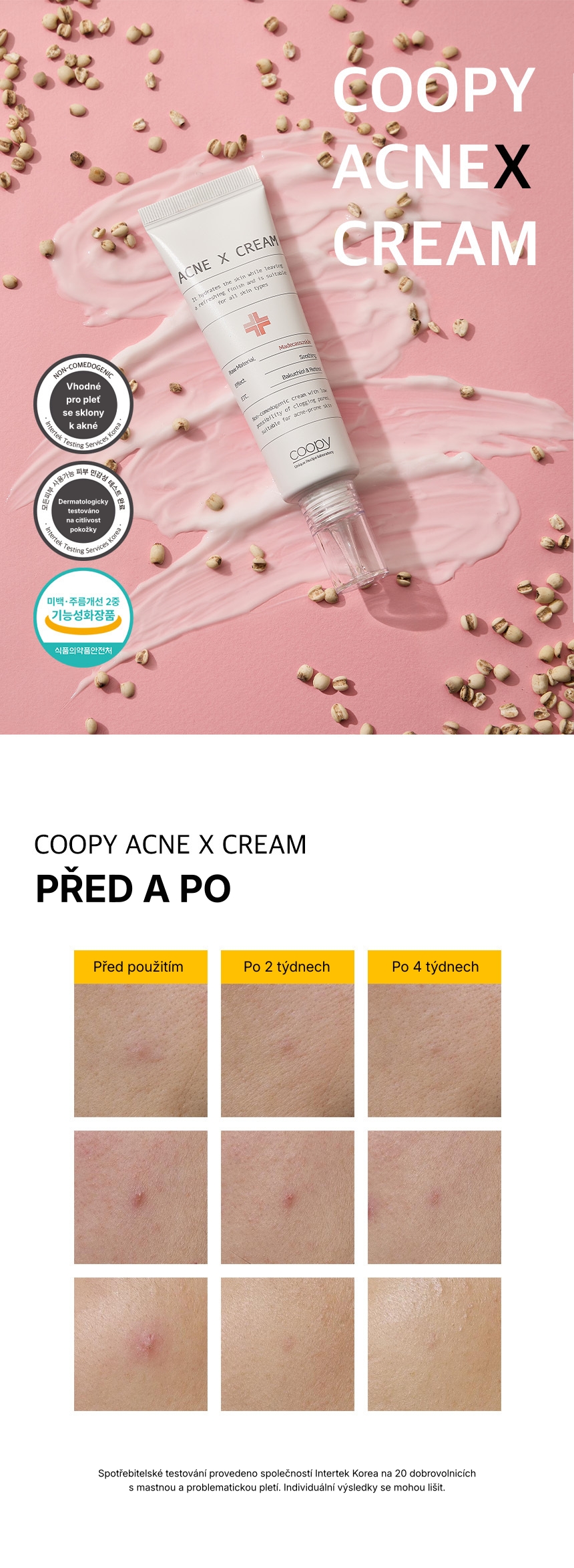 1.0. Detailed Page COOPY Acne x Cream